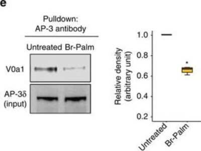 Western Blot: ATP6V0A1 Antibody [NBP1-89342]
