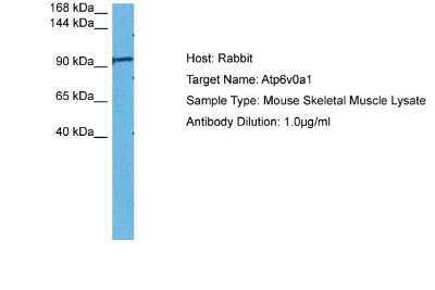 Western Blot: ATP6V0A1 Antibody [NBP2-87054]
