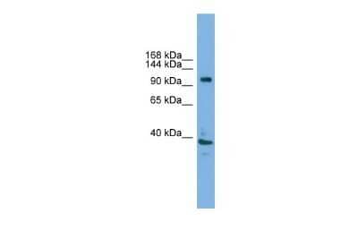 Western Blot: ATP6V0A1 Antibody [NBP2-87054]