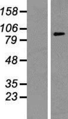 Western Blot: ATP6V0A1 Overexpression Lysate [NBP2-07782]