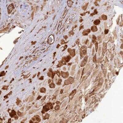 Immunohistochemistry-Paraffin: ATP6V0A2 Antibody [NBP1-91690]