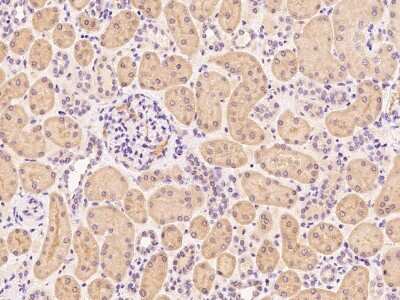 Immunohistochemistry-Paraffin: ATP6V0A2 Antibody [NBP2-99457]