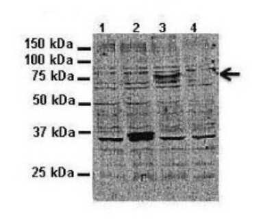 Western Blot: ATP6V0A2 Antibody [NBP1-59069]