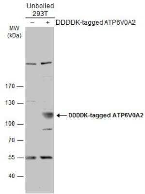 Western Blot: ATP6V0A2 Antibody [NBP2-15516]