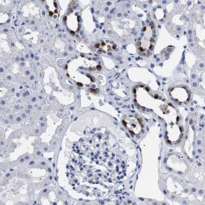 Immunohistochemistry-Paraffin: ATP6V0A4 Antibody [NBP1-89330]