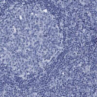 Immunohistochemistry-Paraffin: ATP6V0A4 Antibody [NBP1-89330]