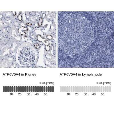 Immunohistochemistry-Paraffin: ATP6V0A4 Antibody [NBP1-89330]