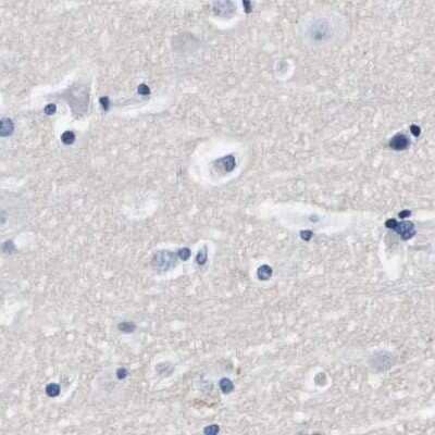 Immunohistochemistry-Paraffin: ATP6V0A4 Antibody [NBP1-89330]
