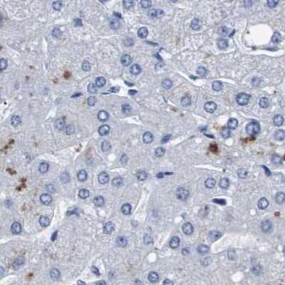 Immunohistochemistry-Paraffin: ATP6V0A4 Antibody [NBP1-89330]