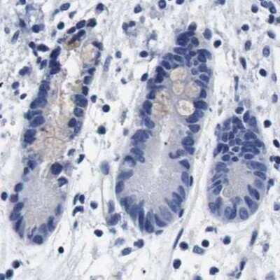 Immunohistochemistry-Paraffin: ATP6V0A4 Antibody [NBP1-89330]