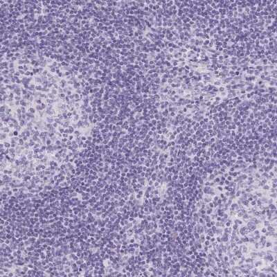 Immunohistochemistry-Paraffin: ATP6V0A4 Antibody [NBP2-39030]