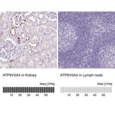 Immunohistochemistry-Paraffin: ATP6V0A4 Antibody [NBP2-39030]