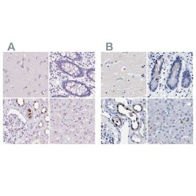 Immunohistochemistry-Paraffin: ATP6V0A4 Antibody [NBP2-39030]