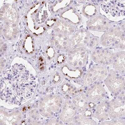 Immunohistochemistry-Paraffin: ATP6V0A4 Antibody [NBP2-39030]