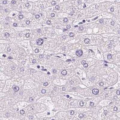 Immunohistochemistry-Paraffin: ATP6V0A4 Antibody [NBP2-39030]