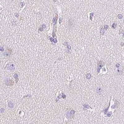 Immunohistochemistry-Paraffin: ATP6V0A4 Antibody [NBP2-39030]