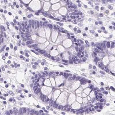 Immunohistochemistry-Paraffin: ATP6V0A4 Antibody [NBP2-39030]