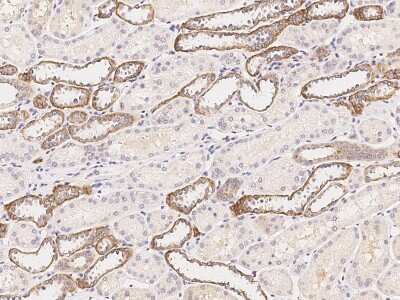 Immunohistochemistry-Paraffin: ATP6V0A4 Antibody [NBP2-99250]