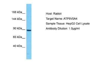 Western Blot: ATP6V0A4 Antibody [NBP2-87055]