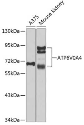 Western Blot: ATP6V0A4 AntibodyBSA Free [NBP2-92499]