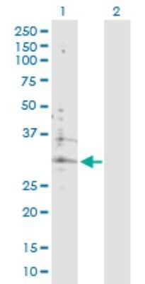 Western Blot: ATP6V0B Antibody [H00000533-D01P]