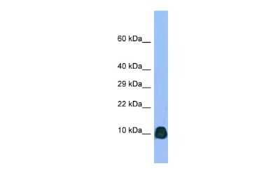 Western Blot: ATP6V0B Antibody [NBP2-83943]