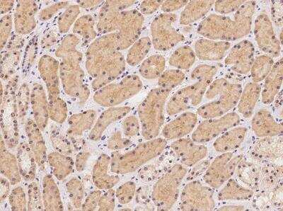 Immunohistochemistry-Paraffin: ATP6V0C Antibody [NBP3-06206]