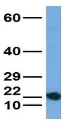 Western Blot: ATP6V0C Antibody [NBP1-59654]
