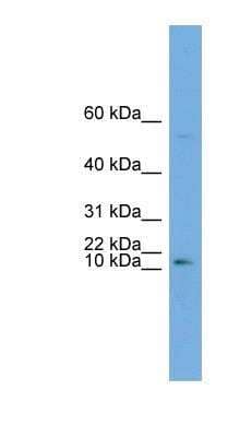 Western Blot: ATP6V0C Antibody [NBP1-59654]