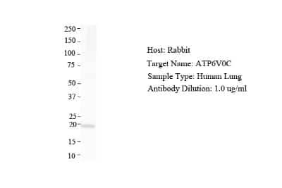 Western Blot: ATP6V0C Antibody [NBP1-59654]