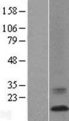 Western Blot: ATP6V0C Overexpression Lysate [NBL1-07833]