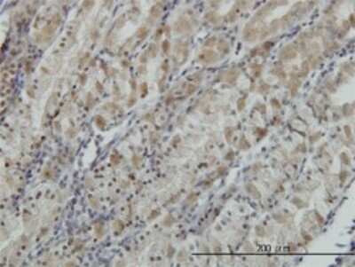 Immunohistochemistry-Paraffin: ATP6V0D1 Antibody (2G12) [H00009114-M01]