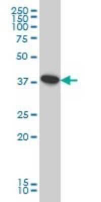 Western Blot: ATP6V0D1 Antibody (2G12) [H00009114-M01]