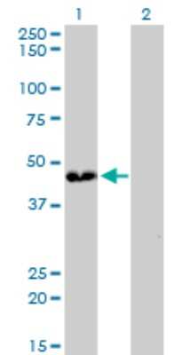 Western Blot: ATP6V0D1 Antibody (2G12) [H00009114-M01]