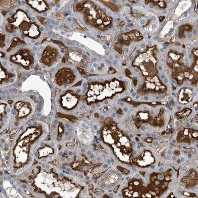 Immunohistochemistry-Paraffin: ATP6V0D1 Antibody [NBP1-88893]