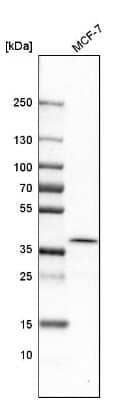 Western Blot: ATP6V0D1 Antibody [NBP1-88893]