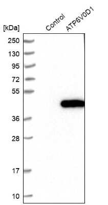 Western Blot: ATP6V0D1 Antibody [NBP1-88893]