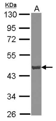 Western Blot: ATP6V0D1 Antibody [NBP2-15517]