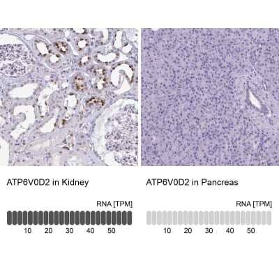 Immunohistochemistry-Paraffin: ATP6V0D2 Antibody [NBP2-31600]