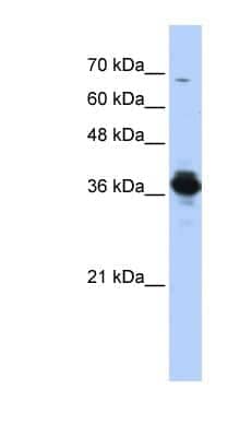 Western Blot: ATP6V0D2 Antibody [NBP1-54595]