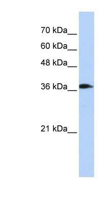 Western Blot: ATP6V0D2 Antibody [NBP1-54857]