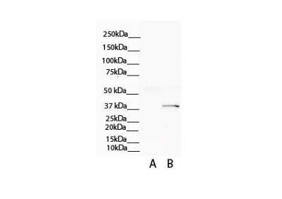 Western Blot: ATP6V0D2 Antibody [NBP1-54857]