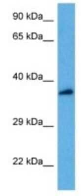 Western Blot: ATP6V0D2 Antibody [NBP3-10978]