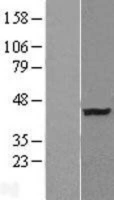 Western Blot: ATP6V0D2 Overexpression Lysate [NBL1-07835]