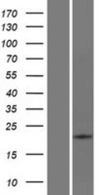 Western Blot: ATP6V0E2 Overexpression Lysate [NBP2-08257]