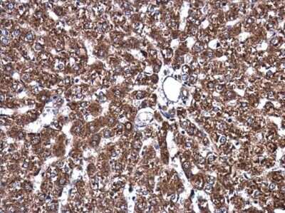 Immunohistochemistry-Paraffin: ATP6V1A Antibody (GT3846) [NBP3-13540]