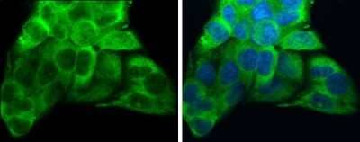 Immunocytochemistry/ Immunofluorescence: ATP6V1A Antibody (GT811) [NBP3-13541]