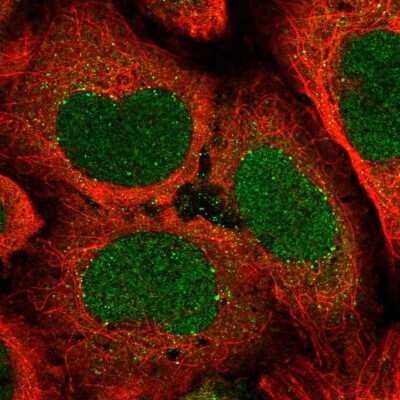 Immunocytochemistry/ Immunofluorescence: ATP6V1A Antibody [NBP2-55164]