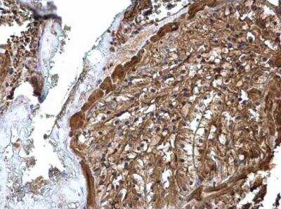 Immunohistochemistry: ATP6V1A Antibody [NBP1-33021]