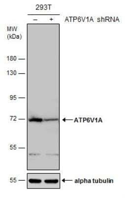 Knockout Validated: ATP6V1A Antibody [NBP1-33021]